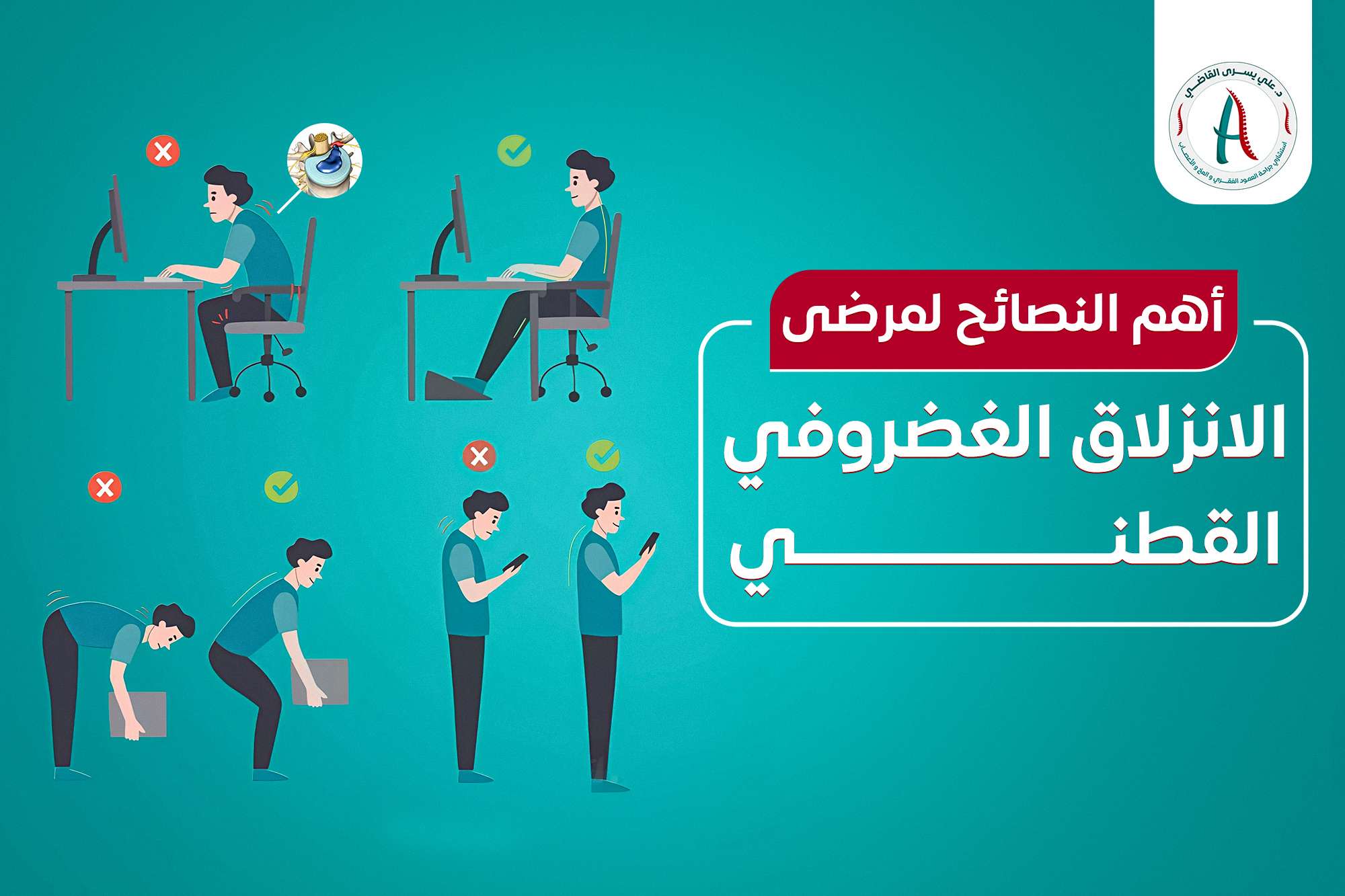عملية الانزلاق الغضروفي القطني وتثبيت الفقرات