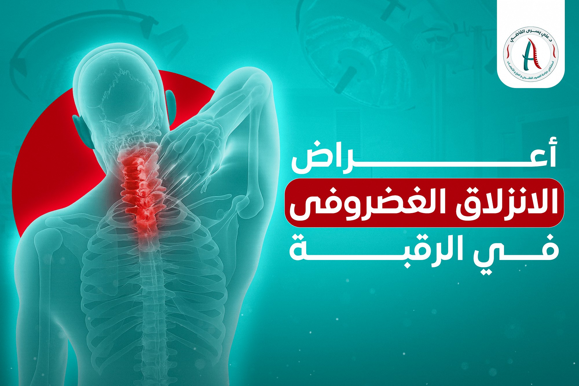 اعراض الانزلاق الغضروفي في الرقبة