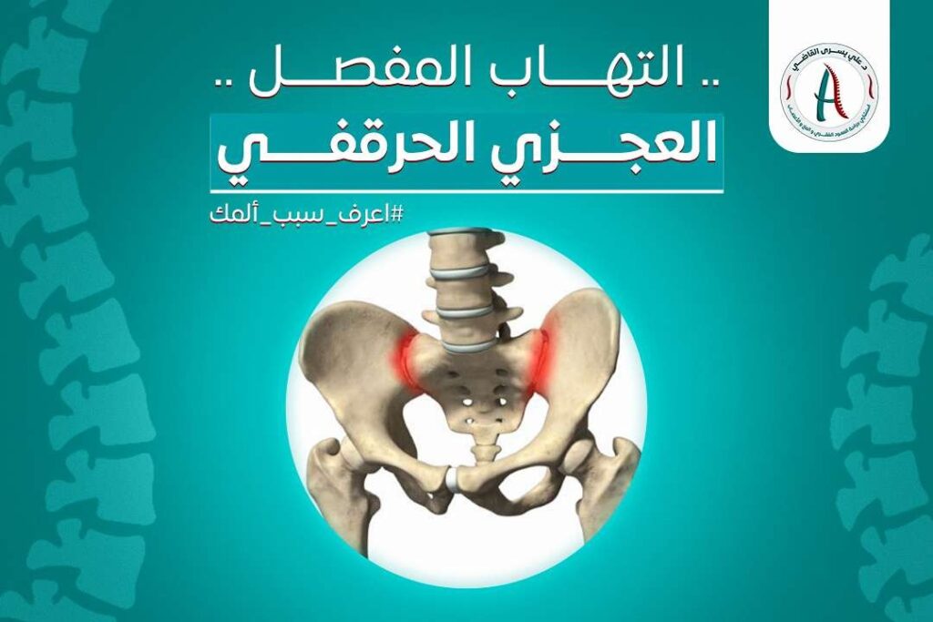 هل التهاب المفصل العجزي الحرقفي خطير​